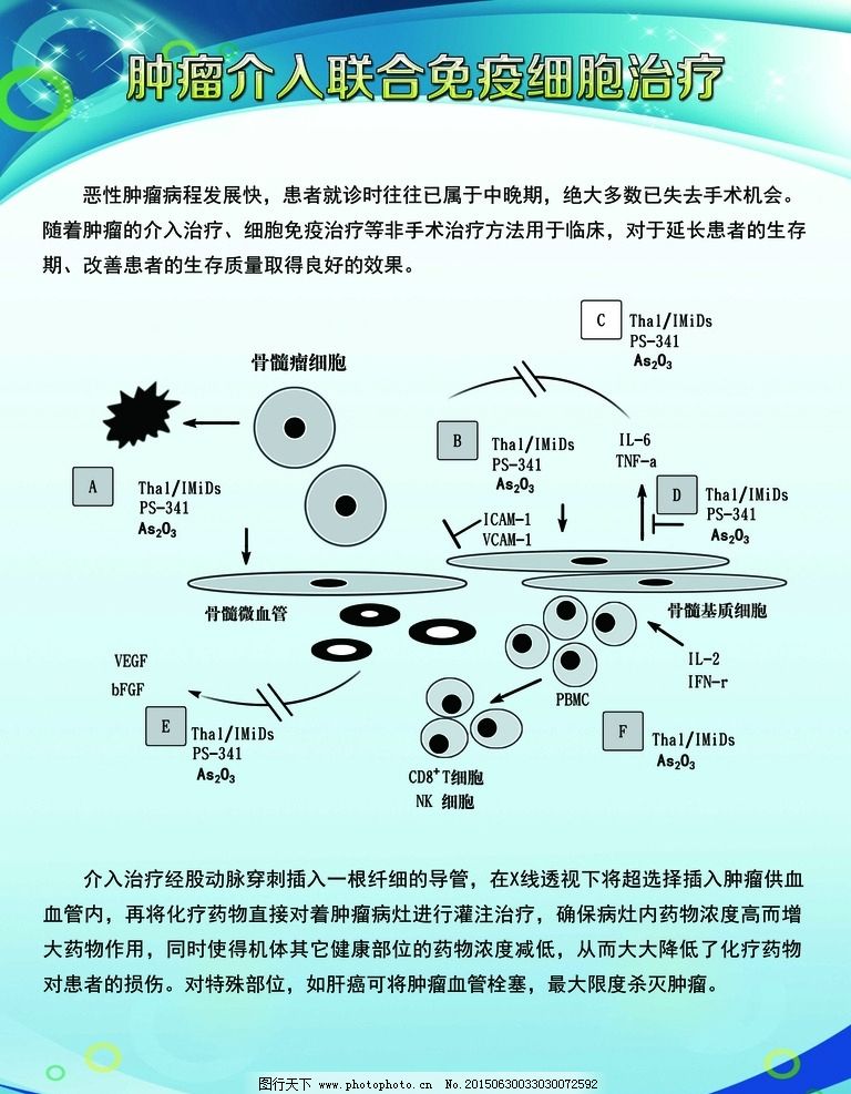 肿瘤介入免疫细胞治疗 医疗展板图片